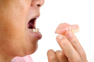 If you must choose dentures, Dr. Hadgis will make sure they are the best they can be.