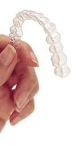 Image of an Invisalign invisible aligner